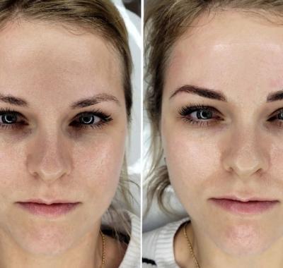 microblading-brwi-1
