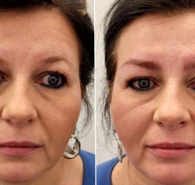 microblading-brwi-16